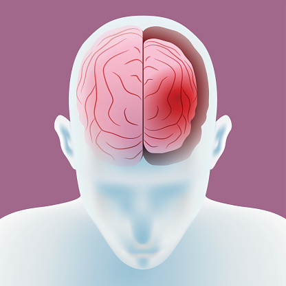 Brain Shrinks by 5 Percent Beginning at 45; Experts Say Banish ...